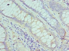 Polyclonal Rabbit anti-Human FGF1 / Acidic FGF Antibody (aa16-155, IHC)