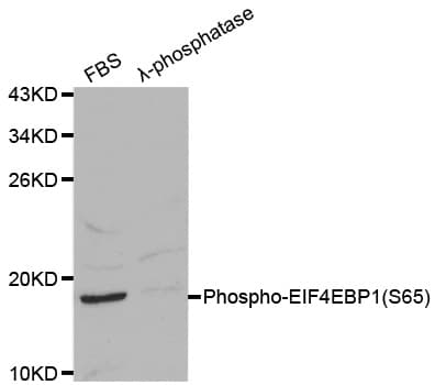 Polyclonal Rabbit anti-Human EIF4EBP1 / 4EBP1 Antibody (phospho-Ser65, WB)