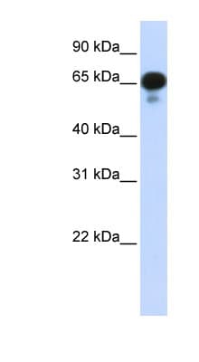 PPM1J Antibody (aa71-120)