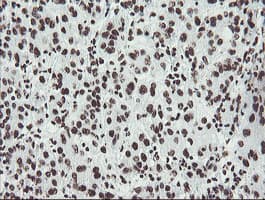NONO / P54NRB Antibody (aa184-385, clone OTI5F1)