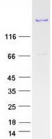 Human ANK2 / Ankyrin B Protein (Recombinant Myc-DDK (Flag))