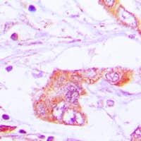 Polyclonal Rabbit anti-Human APOE / Apolipoprotein E Antibody (Internal, IHC, WB)