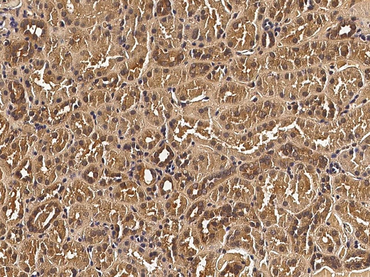 Monoclonal Mouse anti-Human VEGFA / VEGF Antibody (clone 02, Preservative Free, IHC)