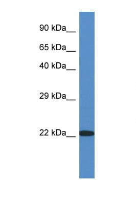 RPL14 / Ribosomal Protein L14 Antibody (C-Terminus, HRP)