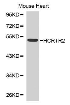 Polyclonal Rabbit anti-Human OX2R / Orexin Receptor 2 Antibody (WB)