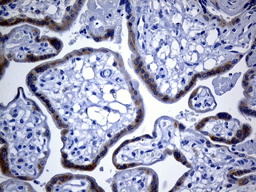IMP-3 / IGF2BP3 Antibody (clone OTI4H5, Carrier-free)