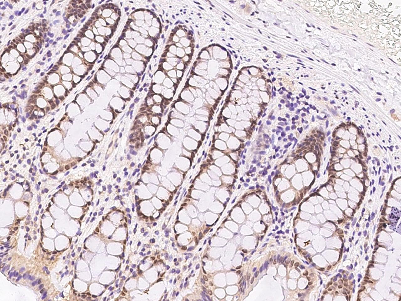 FOXP2 Antibody