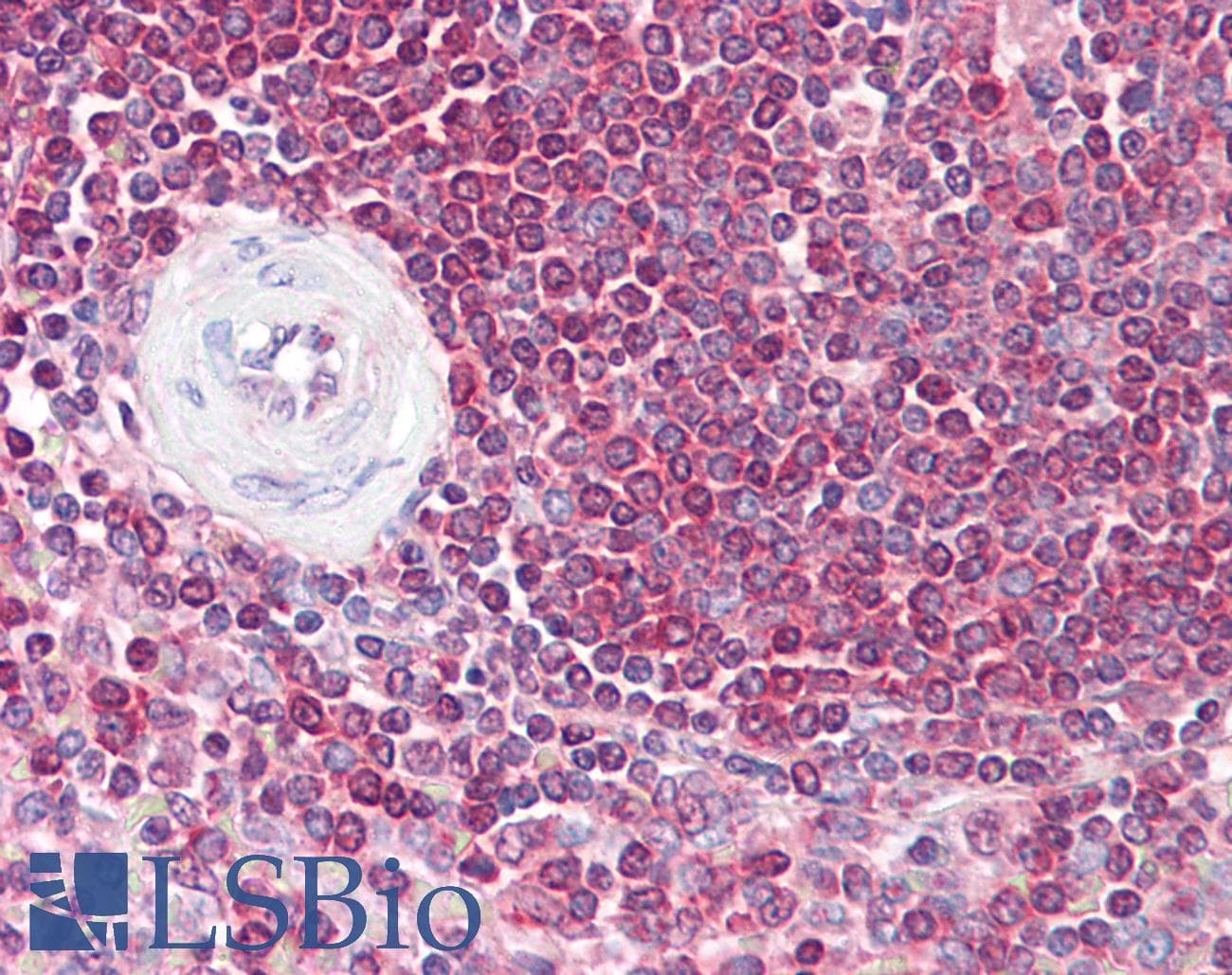 IHC-plus™ GFI1 Antibody (aa280-330)