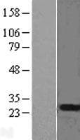 MAD2B / REV7 Protein (Over-Expression Lysate Myc-DDK (Flag))