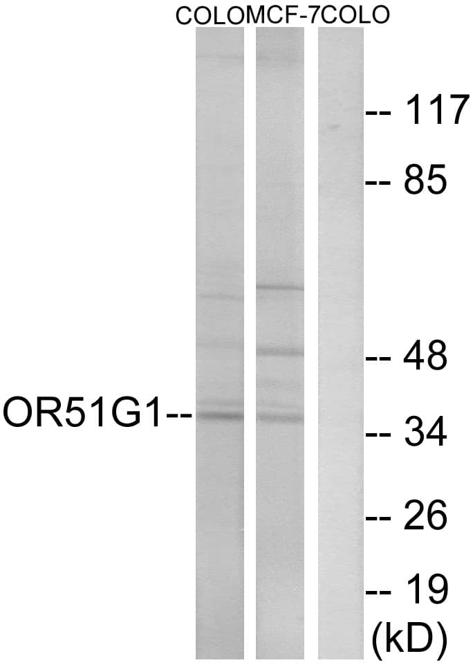 Polyclonal Rabbit anti-Human OR51G1 Antibody (aa199-248, WB)