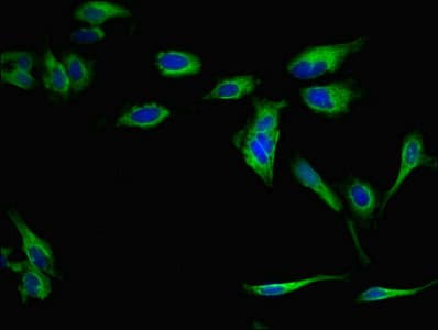 Polyclonal Rabbit anti-Human RP2 Antibody (IHC, IF)