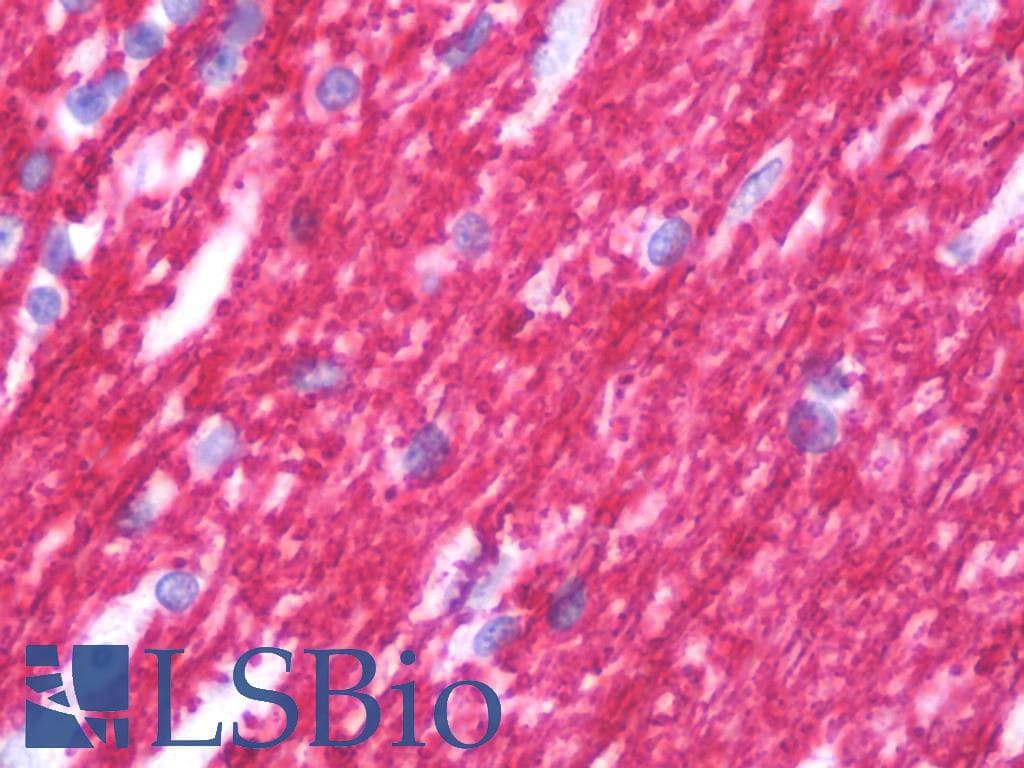 PathPlus™ MBP / Myelin Basic Protein Antibody