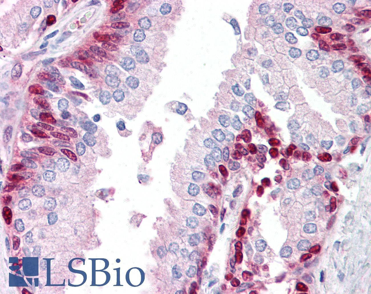 IHC-plus™ Polyclonal Rabbit anti-Human TRIP / LRRFIP1 Antibody (IHC, IF, WB)