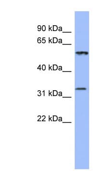 DDC / DOPA Decarboxylase Antibody (aa359-408)