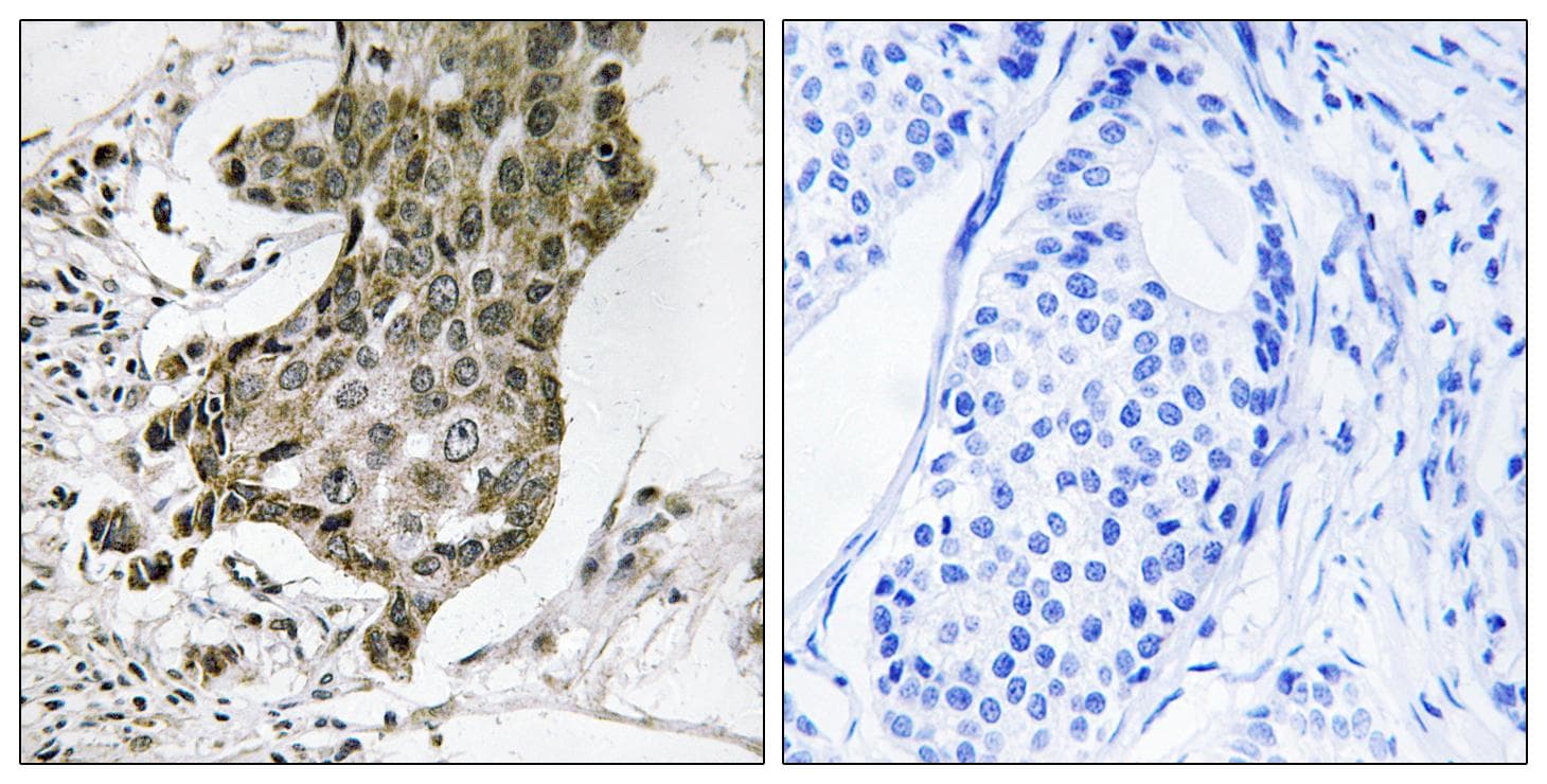 RABEP1 / Rabaptin-5 Antibody