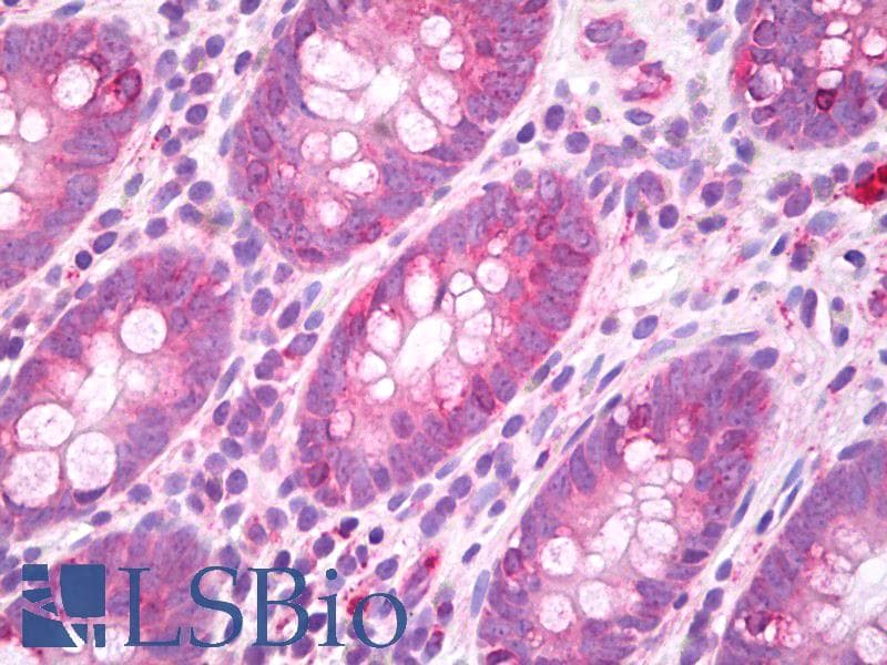 IHC-plus™ GJA3 / CX46 / Connexin 46 Antibody (aa108-139)