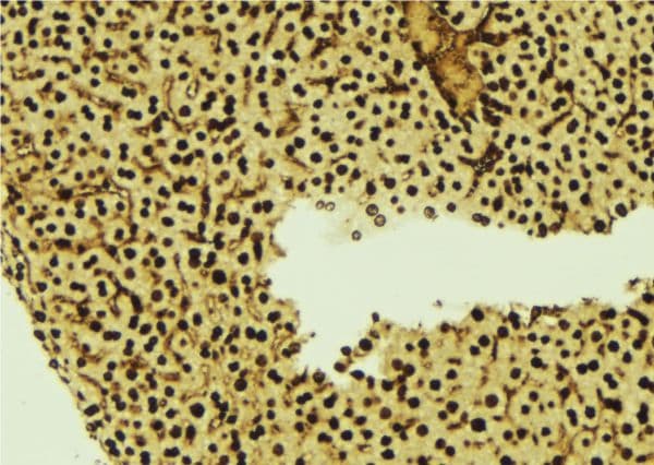 Polyclonal Rabbit anti-Human TMPO / TP / Thymopoietin Antibody (IHC, WB)