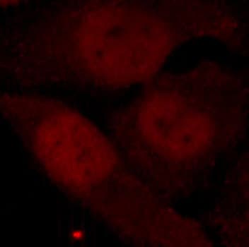 HDAC2 Antibody (phospho-Ser394)