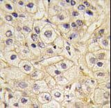 Polyclonal Rabbit anti-Human Rhodopsin Kinase / GRK1 Antibody (aa520-550, IHC, WB)