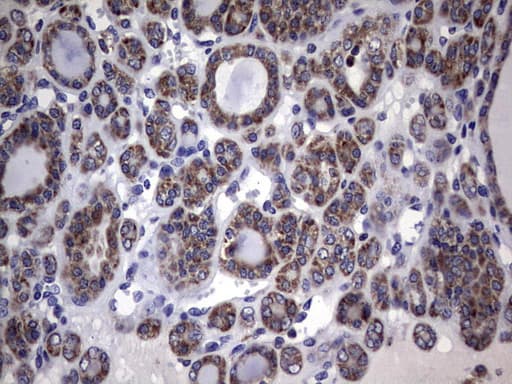 DDOST / OST48 Antibody (aa131-378, clone OTI2H2)