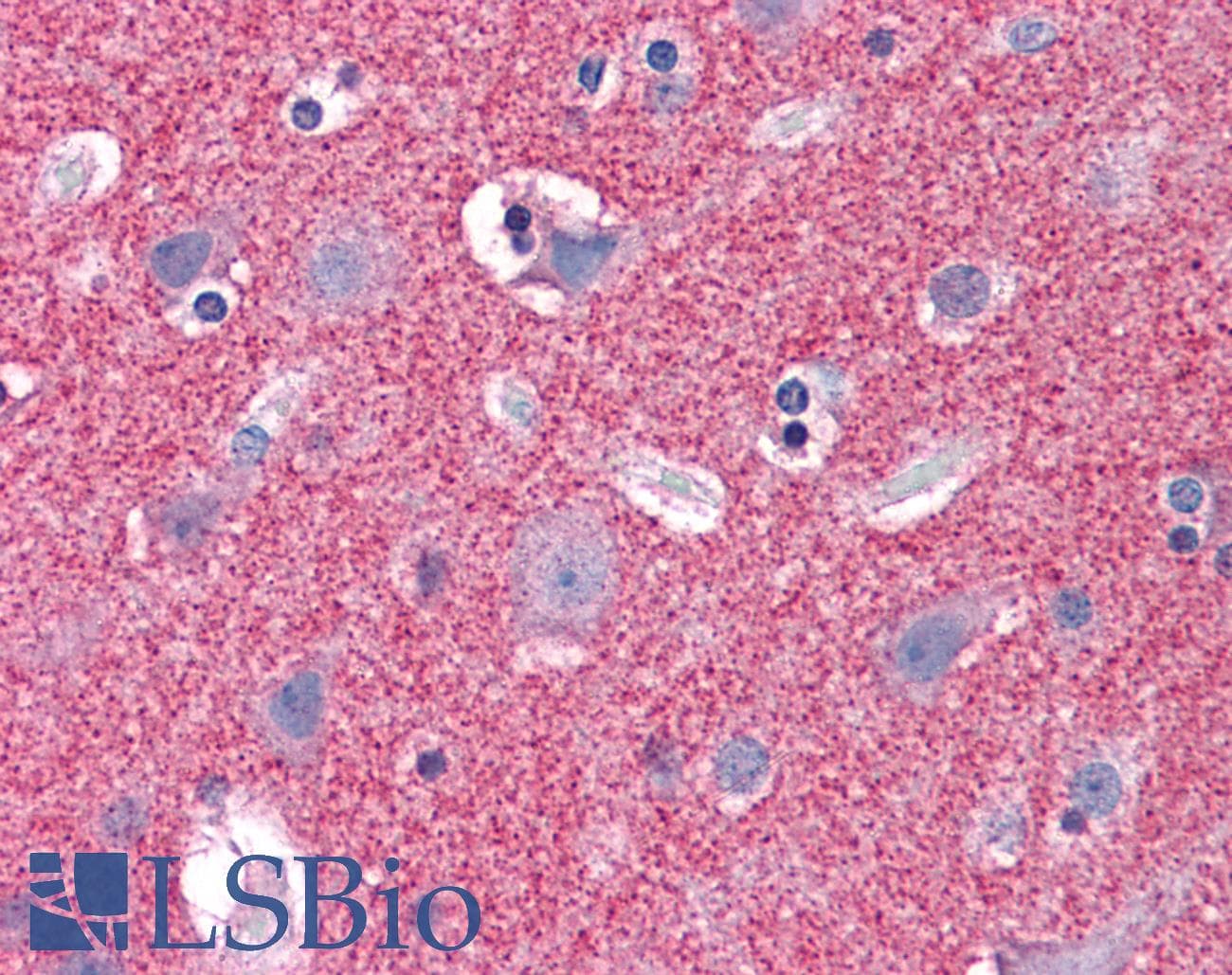 IHC-plus™ SEPT3 / Septin 3 Antibody (aa15-26)