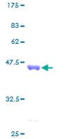 Human CCL13 / MCP4 Protein (Recombinant GST)