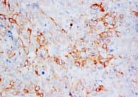 Monoclonal Mouse anti-Human KRT13 / CK13 / Cytokeratin 13 Antibody (clone CK-13, IHC)