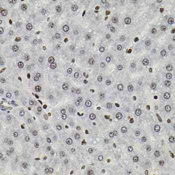 SOCS1 Antibody