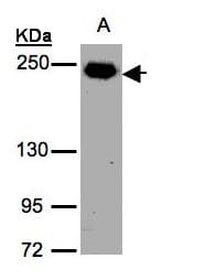 Polyclonal Rabbit anti-Human TJP1 / ZO-1 Antibody (aa1574-1748, WB)