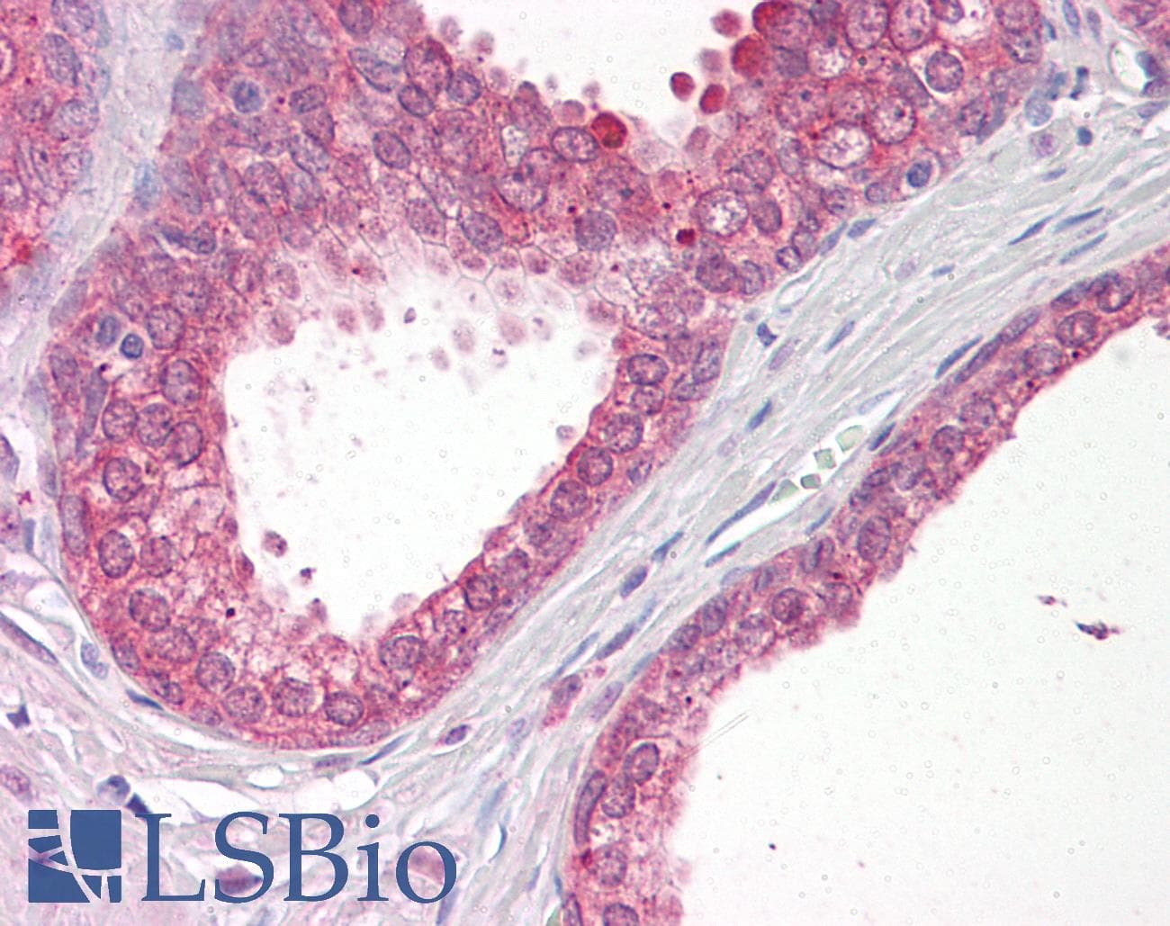 IHC-plus™ VPS41 Antibody (aa499-512)