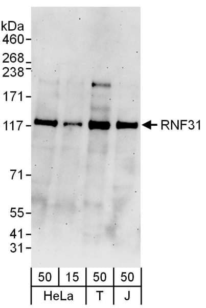 Polyclonal Rabbit anti-Human RNF31 Antibody (aa1022-1072, WB)