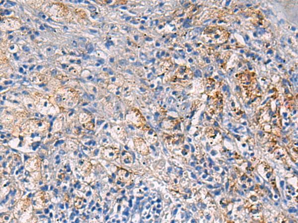 NFKB1 / NF-Kappa-B Antibody