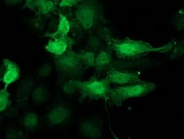 Monoclonal Mouse anti-Human CDK2 Antibody (clone OTI2D9, IHC, IF, WB)