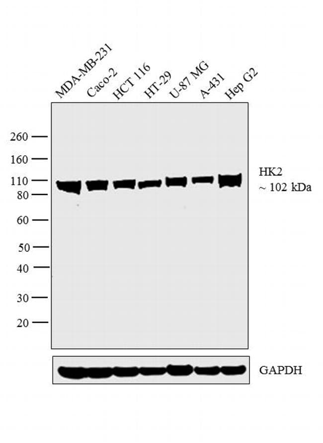 HK2 / Hexokinase 2 Antibody (clone 3D3)