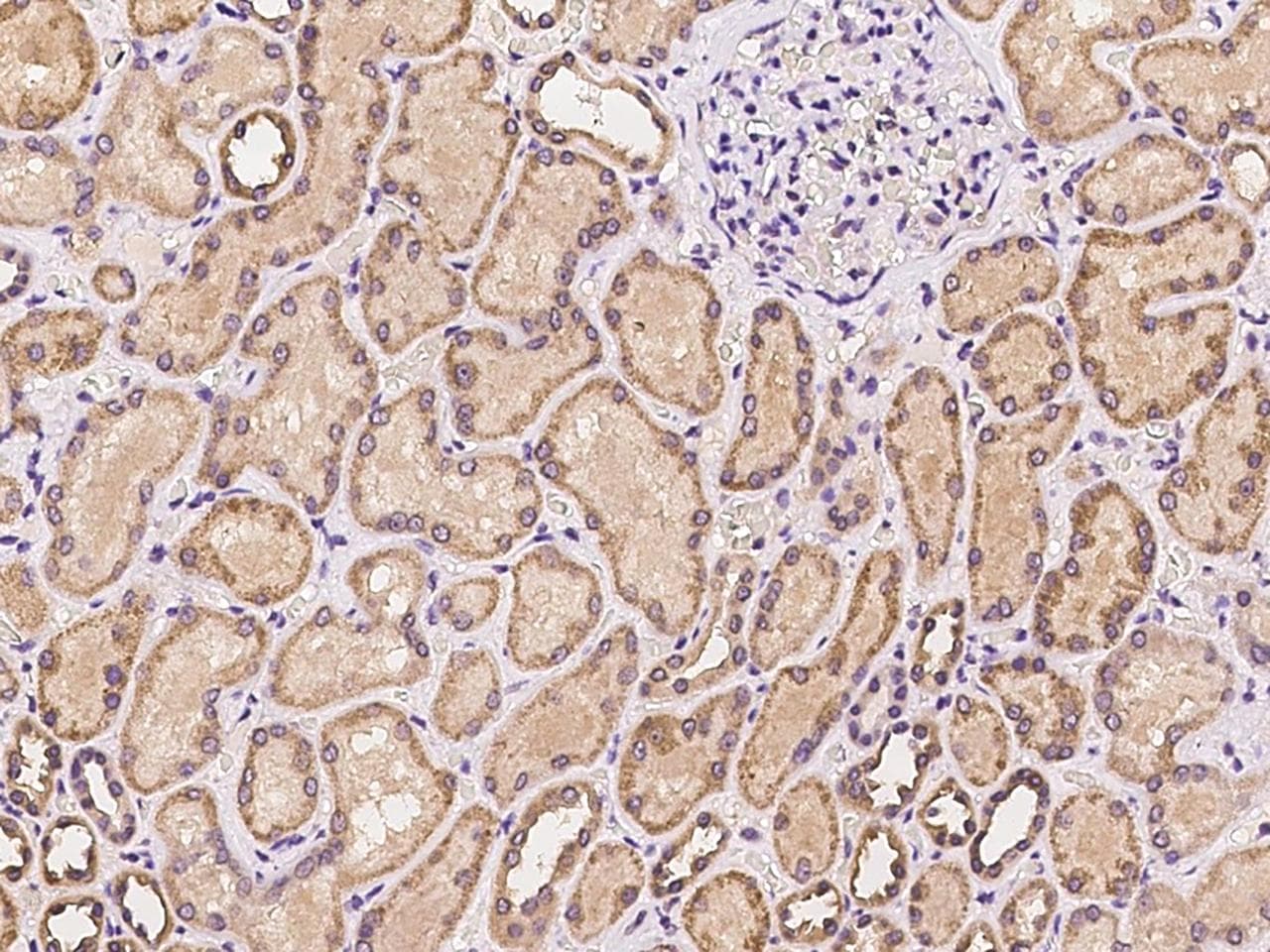 Polyclonal Rabbit anti-Human PKD3 / PRKD3 Antibody (IHC)