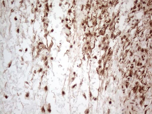 IRS1 Antibody (aa1-280, clone OTI3G10)