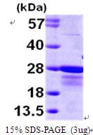 Human CBFB Protein (Recombinant His)