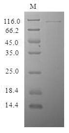 Human CRISPLD2 Protein (Recombinant MBP, N-terminus + 6His, C-terminus)