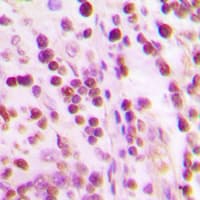 XRCC6 / Ku70 Antibody (N-Terminus)