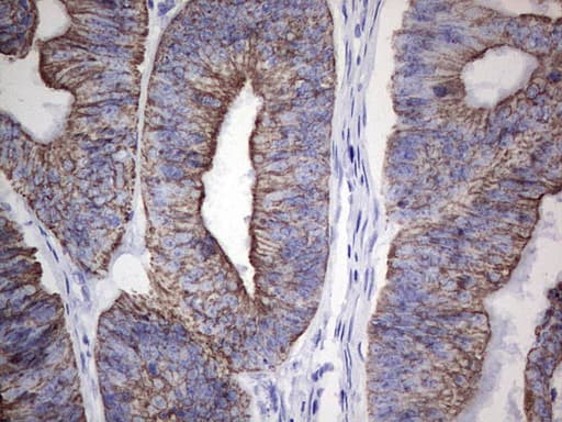 Acidic Cytokeratin Antibody (clone 8A3)