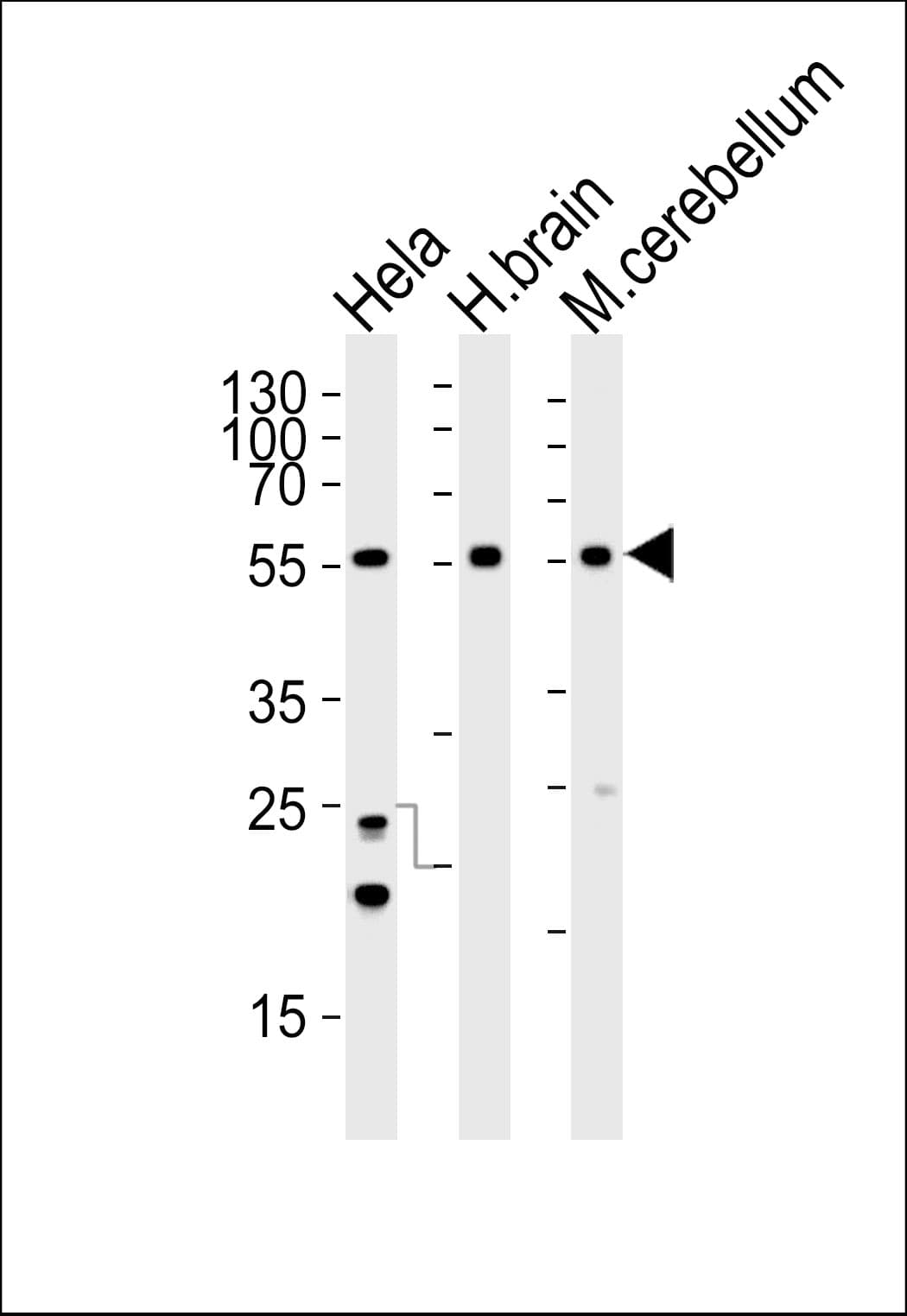 Polyclonal Rabbit anti-Human PFTK1 / CDK14 Antibody (aa1-30, IHC, WB)