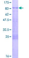 Human ER Alpha / Estrogen Receptor Protein (Recombinant GST)