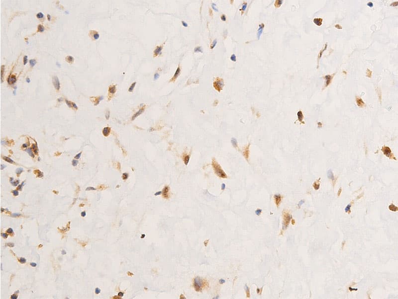 Polyclonal Rabbit anti-Human JUN / c-Jun Antibody (phospho-Tyr170, IHC, WB)