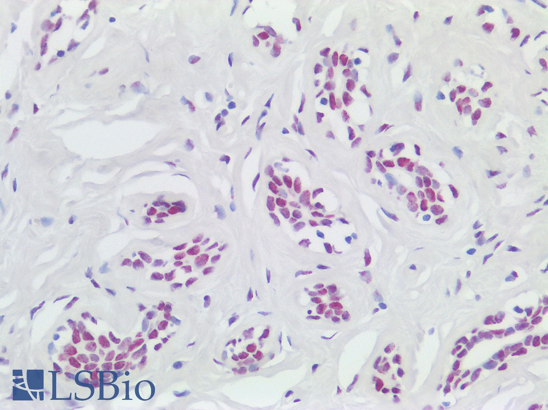 IHC-plus™ Polyclonal Rabbit anti-Human KHSRP / FBP2 Antibody (aa100-150, IHC)