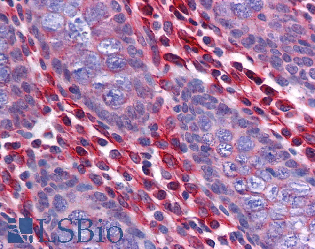 IHC-plus™ STAU1 / Staufen Antibody