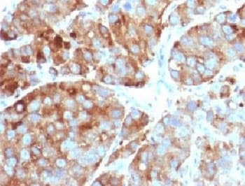 CD63 Antibody (clone CDLA63-1)