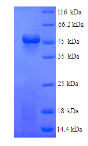 Human FGL2 Protein (Recombinant 6His, N-terminus)