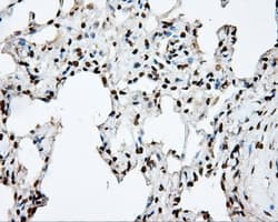 DAPK2 / DAP Kinase 2 Antibody (clone OTI1C5, Carrier-free)