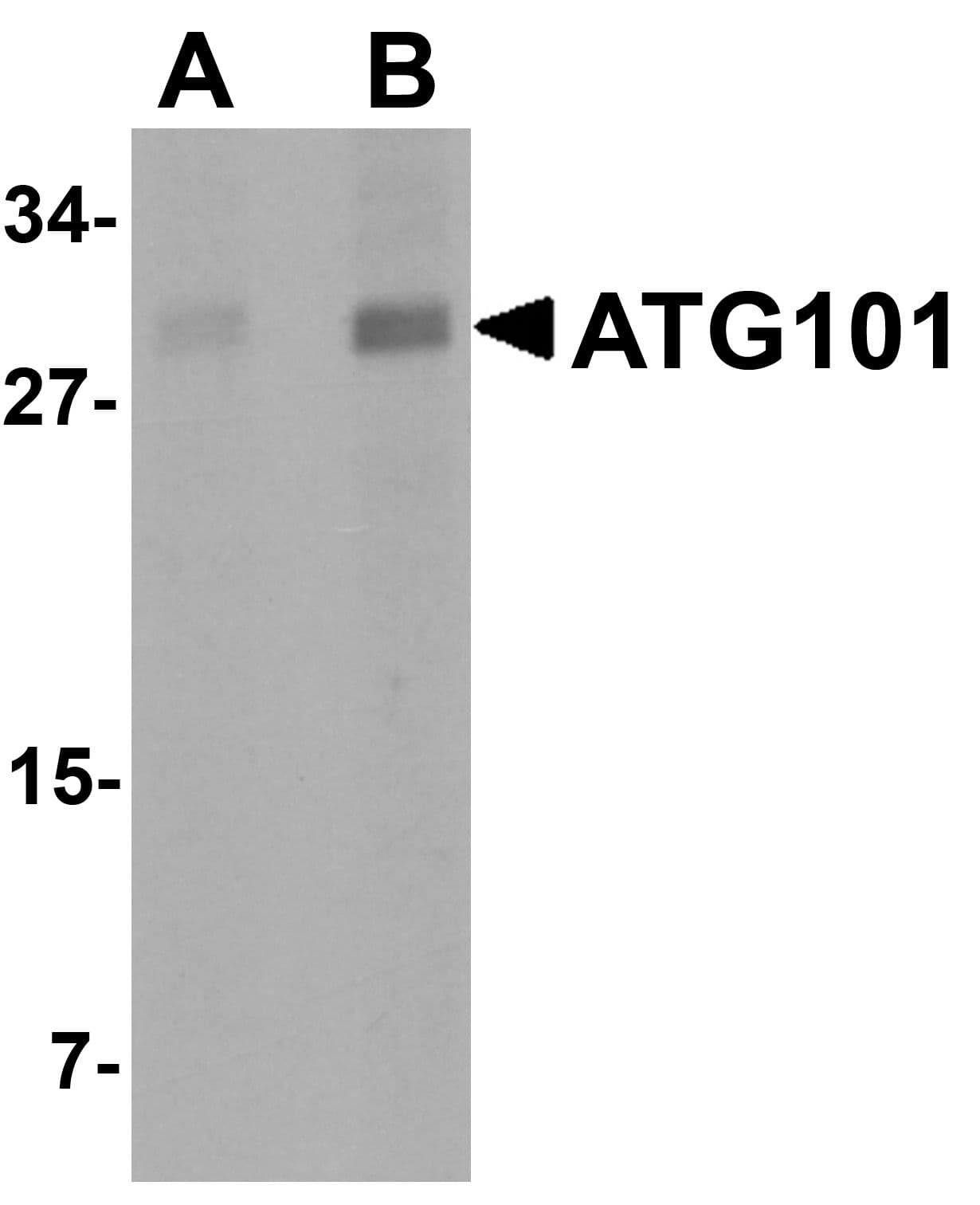 Polyclonal Rabbit anti-Human ATG101 Antibody (IHC, IF, WB)