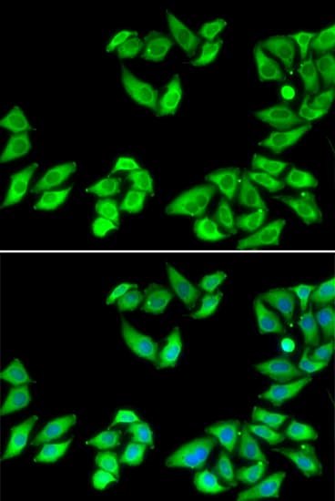 Polyclonal Rabbit anti-Human RPS14 / Ribosomal Protein S14 Antibody (IHC, IF, WB)